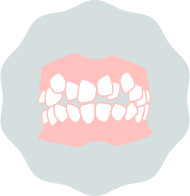 デコボコ・八重歯