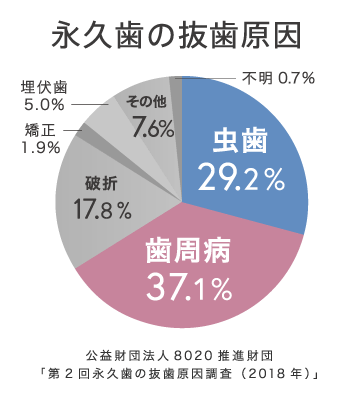 永久歯の抜歯原因